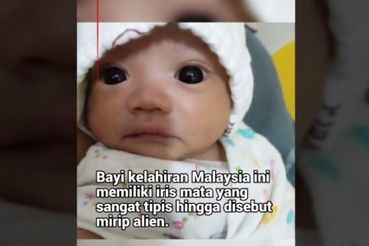 Viral di TikTok! Bayi Alien Bermata Unik di Malaysia Menjadi Perbincangan Netizen, Begini Ungkap Ibunya