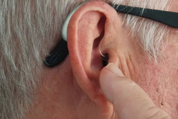 Mengenal Penyakit Stroke Telinga, Benarkah Ada atau Tidak? Berkaca dari Kisah Mertua Kiky Saputri
