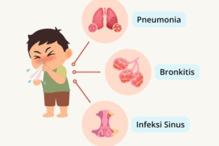 Panduan Lengkap Langkah Pencegahan Influenza A demi Menjaga Kesehatan Keluarga dan Sekitar