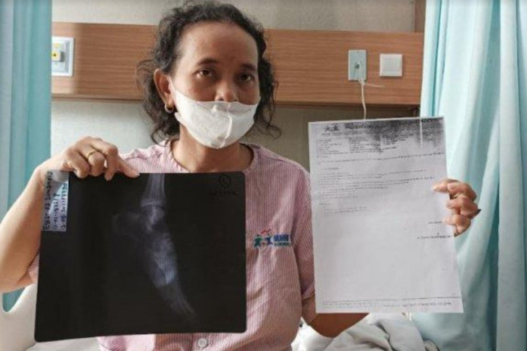 Rumah Sakit Murni Teguh Malpraktik Salah Operasi, Dilaporkan Kaki Kiri yang Sakit Tetapi Malah Kaki Kanan yang Dioperasi