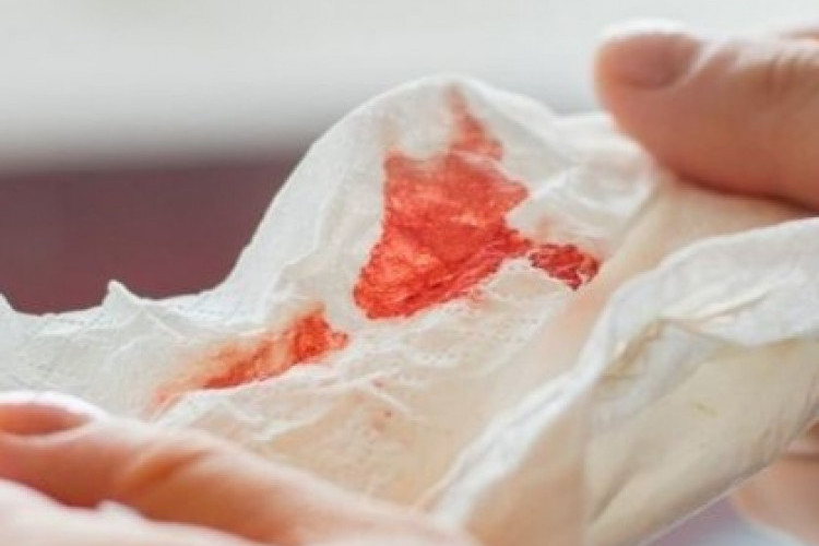 Gambar Muntah Darah Asli di Tisu dan Tangan, Cosplay Sakit-Sakitan!