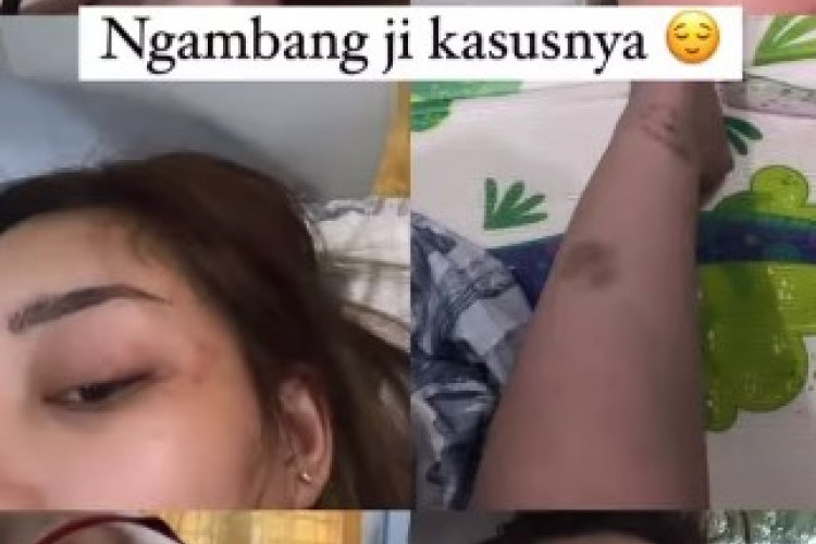 Video Viral Polisi di Makassar Pukul Istri, Sang Istri Influencer Instagram dan Banyak Dukungan Dari Berbagai Pihak