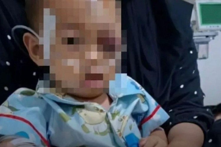 Video ODGJ Lempar Batu ke Kepala Balita Viral di Media Sosial, Begini Kondisi Terkini Korban Usai Dilarikan ke Rumah Sakit