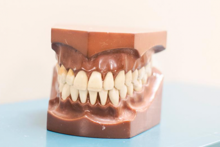 Harga Pasang Gigi Palsu 1 Biji Terbaru 2023, Lengkap dengan Prosedur Pelaksanaannya