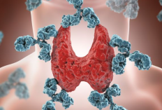 Gejala Penyakit Hipertiroid Beserta Penyebab dan Cara Pengobatan yang Baik