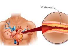 Berapa Kode ICD 10 Pada Kolesterol? Berikut Penjelasan Lengkap Beserta Penyebabnya!