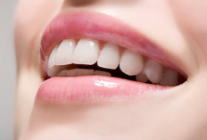 Cara Menghilangkan Karang Gigi dalam Waktu 5 Menit, Terbukti Ampuh! Gigi Langsung Bercahaya