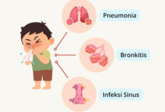 Panduan Lengkap Langkah Pencegahan Influenza A demi Menjaga Kesehatan Keluarga dan Sekitar