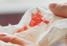 Gambar Muntah Darah Asli di Tisu dan Tangan, Cosplay Sakit-Sakitan!