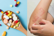 Daftar Salep Obat Gatal Mudah Ditemukan dan Diaplikasikan, Terlihat Hasil Sejak Pemakaian Pertama!