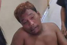 VIRAL Kodok Medan Meninggal Dunia, Intip Kronologi dan Penyebab Tewasnya Pengamen Jalanan yang Bikin Sedih