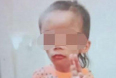 Sering Rewel, Bocah 7 Tahun di Malang Dianiaya Keluarga: Tangan Lidah Disundut Rokok, Dimasukkan ke Air Mendidih, Sampai Dicekik 
