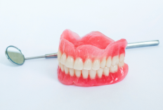 Resiko Pemasangan Gigi Palsu Permanen, Bisa Timbulkan Infeksi Hingga Masalah di Rongga Sinus