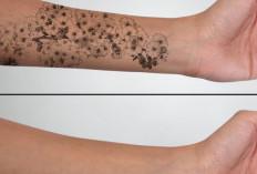 Cara Menghilangkan Tato Dengan Sabun Colek, Jadi Alternatif Selain Laser: Emang Bisa?