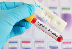 Prosedur Tes Sifilis di Puskesmas Gratis, Bisa Pakai BPJS: Segera Periksakan Dirimu 