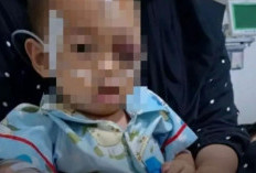 Video ODGJ Lempar Batu ke Kepala Balita Viral di Media Sosial, Begini Kondisi Terkini Korban Usai Dilarikan ke Rumah Sakit