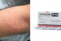 Rekomendasi Obat Gatal Apotek Harga Terjangkau, Dijamin Ampuh Pemakaian Rutin!
