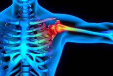 Gejala Penyakit Frozen Shoulder : Sebuah Penyakit yang Menyerang Tulang Sendi di Bahu Akibat Diabetes, Perhatikan Gejala Awalnya!