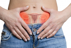 Mengenal Penyakit Kista Ovarium: Gejala, Penyebab dan Cara Mengobati